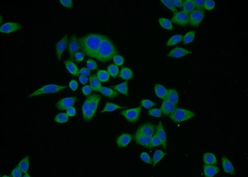 Immunofluorescent analysis of BxPC-3 cells using Catalog No:109306(CTRL Antibody) at dilution of 1:25 and Alexa Fluor 488-congugated AffiniPure Goat Anti-Rabbit IgG(H+L)