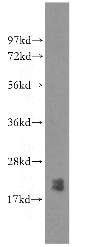 HEK-293 cells were subjected to SDS PAGE followed by western blot with Catalog No:114333(PTRH2 antibody) at dilution of 1:1000