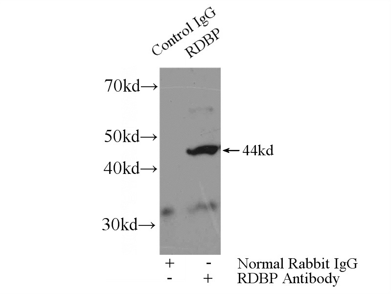 IP Result of anti-RDBP (IP:Catalog No:113111, 4ug; Detection:Catalog No:113111 1:800) with mouse brain tissue lysate 4680ug.