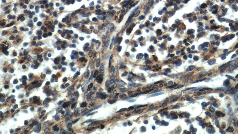 Immunohistochemical of paraffin-embedded human spleen using Catalog No:109074(CCR10 antibody) at dilution of 1:50 (under 40x lens)