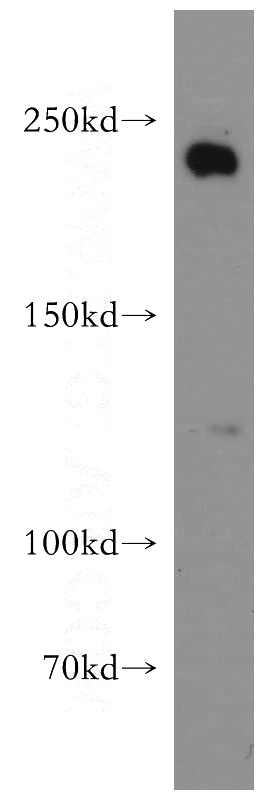 HeLa cells were subjected to SDS PAGE followed by western blot with Catalog No:108132(ANAPC1 antibody) at dilution of 1:1500