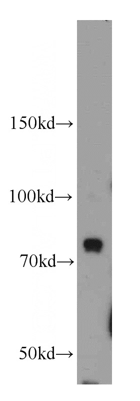 HeLa cells were subjected to SDS PAGE followed by western blot with Catalog No:108381(BCAS3 antibody) at dilution of 1:400