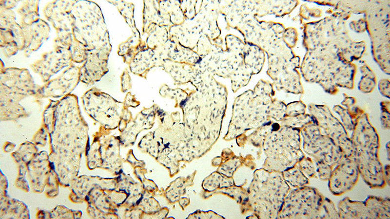 Immunohistochemical of paraffin-embedded human placenta using Catalog No:112298(LOX antibody) at dilution of 1:100 (under 10x lens)