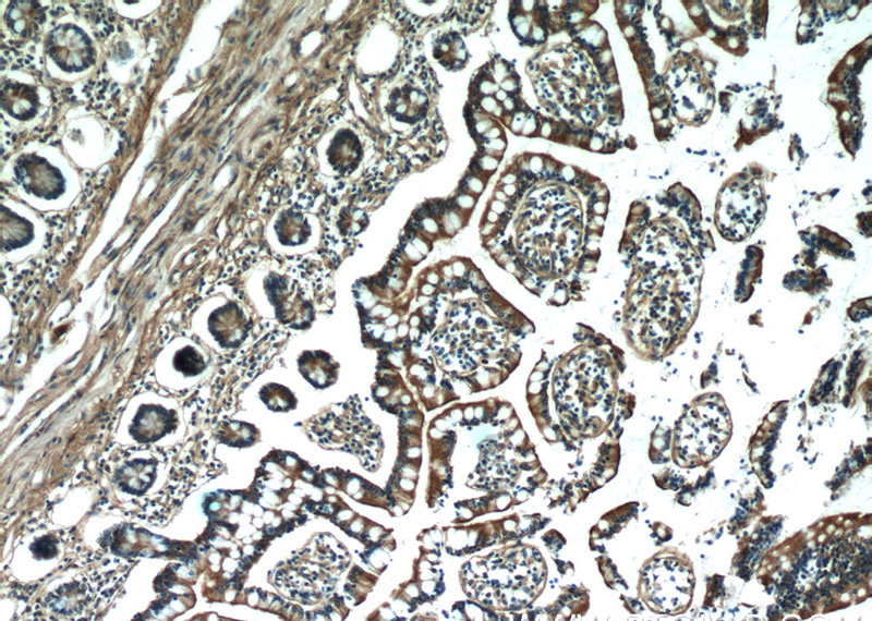 Immunohistochemistry of paraffin-embedded human small intestine tissue slide using Catalog No:112982(MYO1A Antibody) at dilution of 1:50 (under 10x lens)