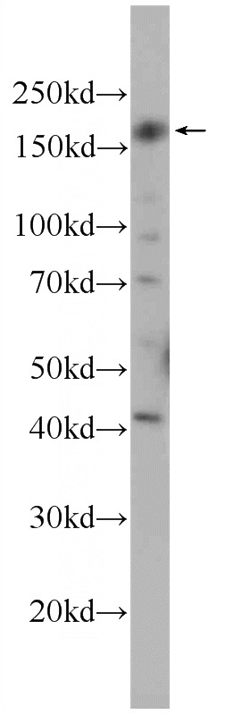HEK-293 cells were subjected to SDS PAGE followed by western blot with Catalog No:109267(CEP164 Antibody) at dilution of 1:300