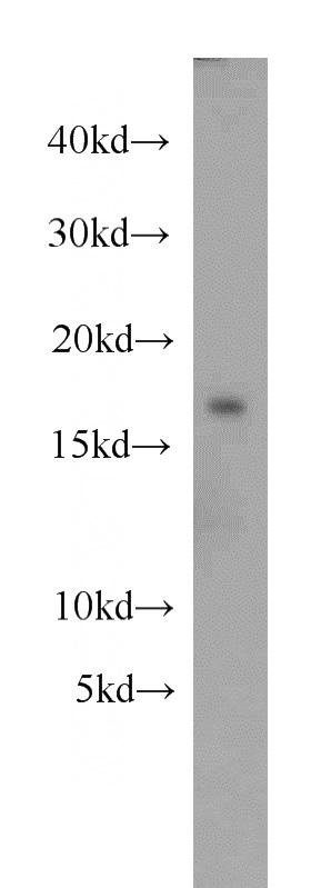mouse heart tissue were subjected to SDS PAGE followed by western blot with Catalog No:112876(MSRB2 antibody) at dilution of 1:1000