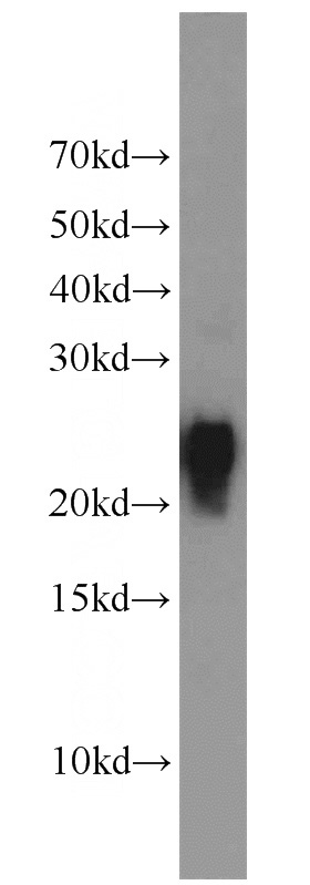 HL-60 cells were subjected to SDS PAGE followed by western blot with Catalog No:116279(TMS1 antibody) at dilution of 1:1000