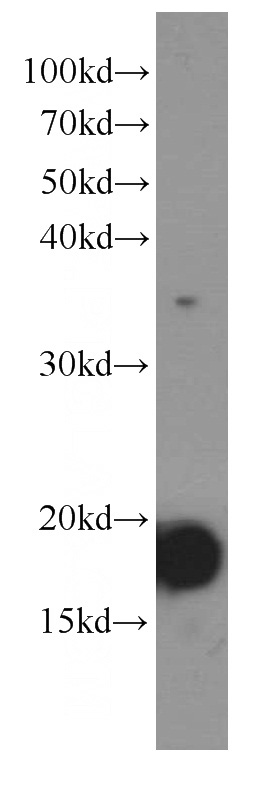 Recombinant protein were subjected to SDS PAGE followed by western blot with Catalog No:107404(IL9 antibody) at dilution of 1:20000