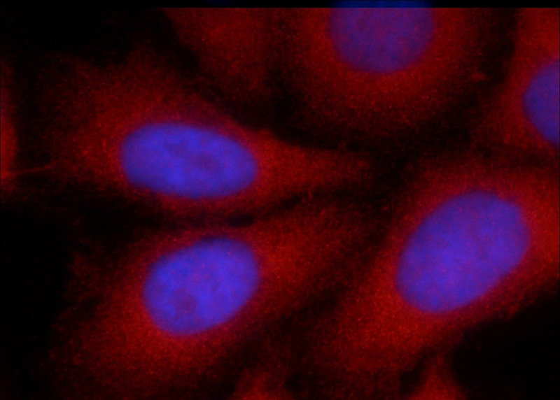 Immunofluorescent analysis of HepG2 cells using Catalog No:108053(AGT Antibody) at dilution of 1:25 and Rhodamine-Goat anti-Rabbit IgG