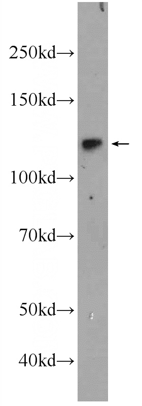 SH-SY5Y cells were subjected to SDS PAGE followed by western blot with Catalog No:113154(NFKB1 Antibody) at dilution of 1:1000