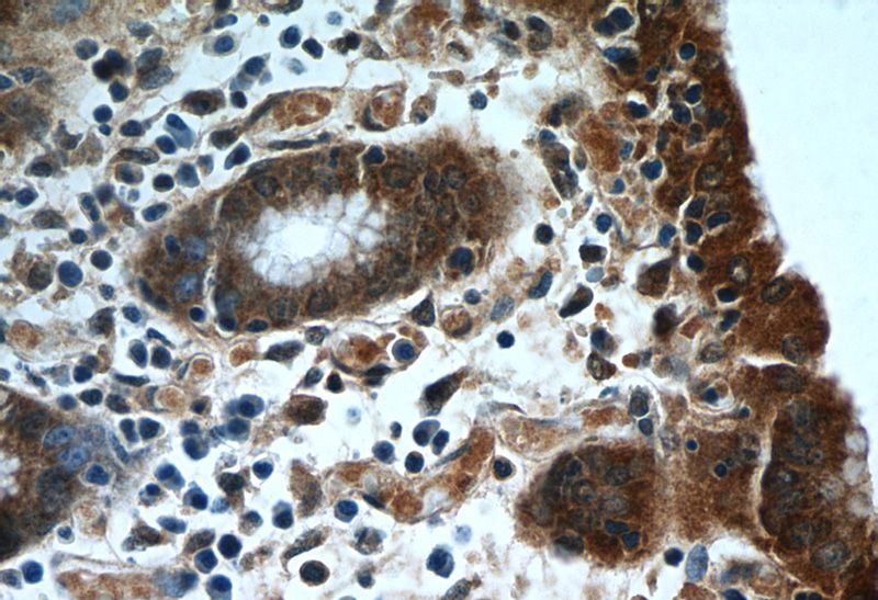 Immunohistochemistry of paraffin-embedded human stomach tissue slide using Catalog No:111410(HIVEP1 Antibody) at dilution of 1:50 (under 40x lens)