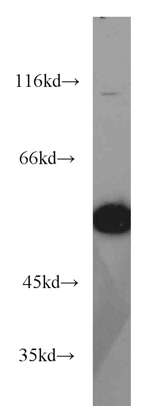 HEK-293 cells were subjected to SDS PAGE followed by western blot with Catalog No:115218(Sestrin2 antibody) at dilution of 1:1000