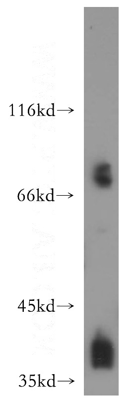 HEK-293 cells were subjected to SDS PAGE followed by western blot with Catalog No:114035(POLR1C antibody) at dilution of 1:800