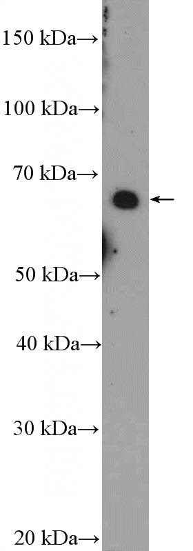 Jurkat cells were subjected to SDS PAGE followed by western blot with Catalog No:111025(GLIS1 Antibody) at dilution of 1:300