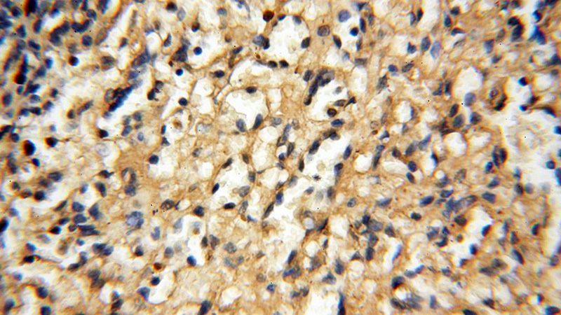 Immunohistochemical of paraffin-embedded human spleen using Catalog No:115760(SYK antibody) at dilution of 1:50 (under 40x lens)