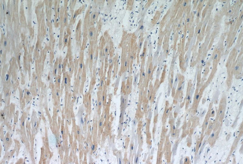 Immunohistochemical of paraffin-embedded human heart using Catalog No:112647(MAP2K5 antibody) at dilution of 1:50 (under 10x lens)