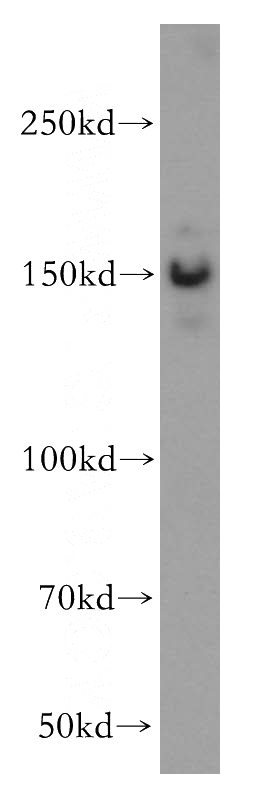 K-562 cells were subjected to SDS PAGE followed by western blot with Catalog No:115432(SMARCC1 antibody) at dilution of 1:500