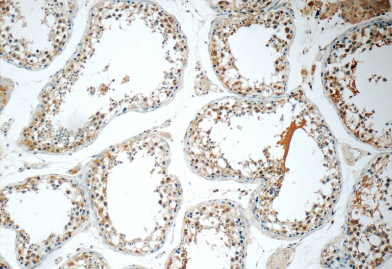 Immunohistochemistry of paraffin-embedded human testis tissue slide using Catalog No:110610(FDXACB1 Antibody) at dilution of 1:50 (under 10x lens)