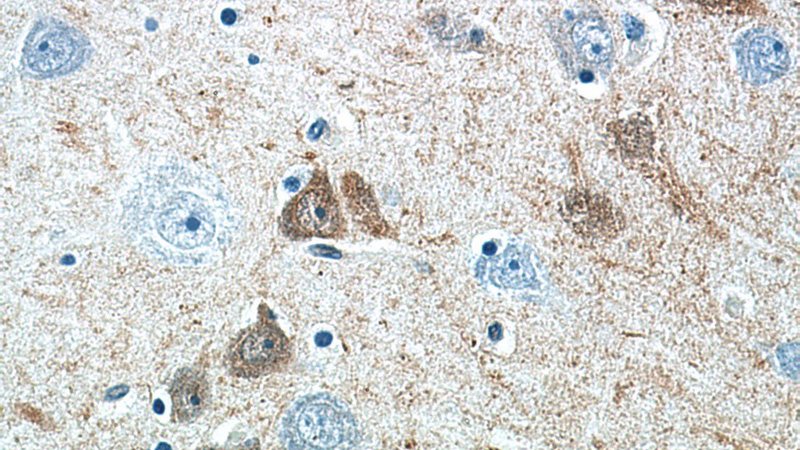 Immunohistochemistry of paraffin-embedded human brain tissue slide using Catalog No:108909(Calretinin Antibody) at dilution of 1:200 (under 40x lens).