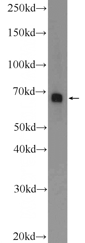 HUVEC cells were subjected to SDS PAGE followed by western blot with Catalog No:108052(ANGPT2 Antibody) at dilution of 1:600
