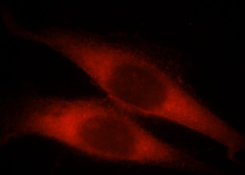Immunofluorescent analysis of Hela cells, using CCDC25 antibody Catalog No:108969 at 1:25 dilution and Rhodamine-labeled goat anti-rabbit IgG (red).