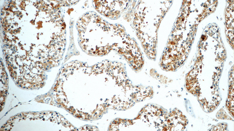 Immunohistochemistry of paraffin-embedded human testis tissue slide using Catalog No:115912(TCN1 Antibody) at dilution of 1:50 (under 10x lens)