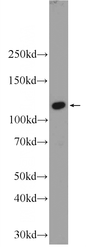 HepG2 cells were subjected to SDS PAGE followed by western blot with Catalog No:110205(EFCAB5 Antibody) at dilution of 1:1000