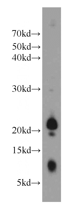 mouse skeletal muscle tissue were subjected to SDS PAGE followed by western blot with Catalog No:110634(FGF18 antibody) at dilution of 1:1000