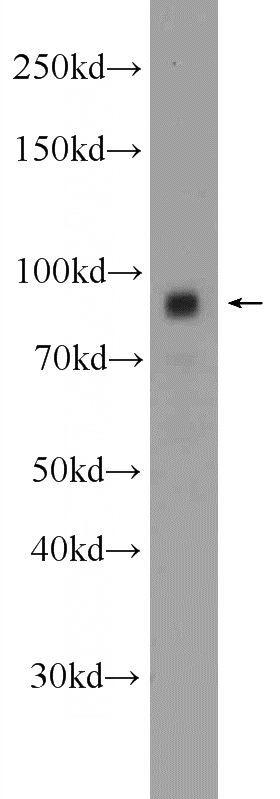 human heart tissue were subjected to SDS PAGE followed by western blot with Catalog No:116407(TRPC4AP Antibody) at dilution of 1:300