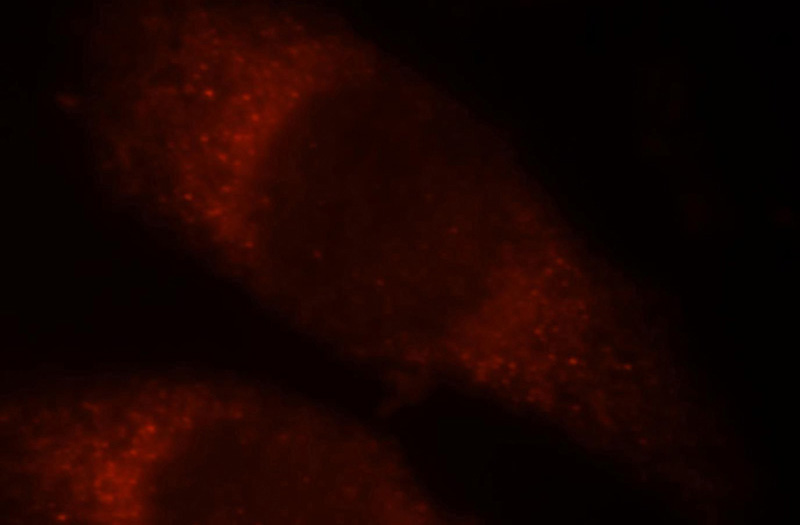 Immunofluorescent analysis of Hela cells, using SESN2 antibody Catalog No:115218 at 1:25 dilution and Rhodamine-labeled goat anti-rabbit IgG (red).