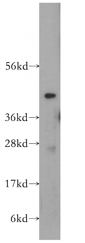 human liver tissue were subjected to SDS PAGE followed by western blot with Catalog No:116785(VPS37A antibody) at dilution of 1:400