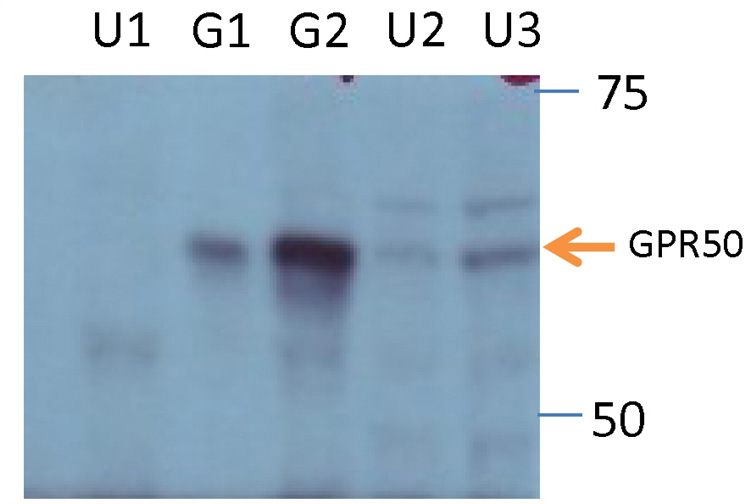 WB result of anti-GPR50 (Catalog No:111130, 1:2000) by Dr. Qian Li, University of Edinburgh. U1: SH-SY5Y cells, untransfected, 10ug; G1: HEK293 cells, with transfected GPR50, 1ug; G2: HEK293 cells, with transfected GPR50, 10ug; U2: HEK293 cells, untransfected, with endogenous GPR50, 10ug; U3: HEK293 cells, untransfected, with endogenous GPR50, 20ug.