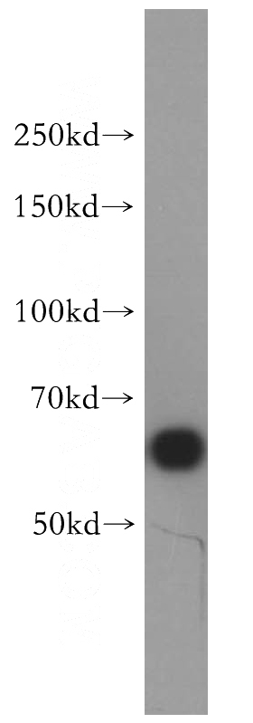 HepG2 cells were subjected to SDS PAGE followed by western blot with Catalog No:111370(HDAC1 antibody) at dilution of 1:500