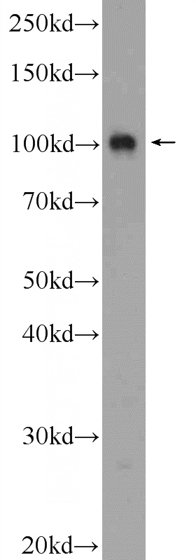 HeLa cells were subjected to SDS PAGE followed by western blot with Catalog No:114348(PWP2 Antibody) at dilution of 1:600
