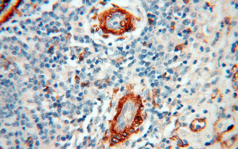 Immunohistochemical of paraffin-embedded human spleen using Catalog No:109054(CD146, MCAM antibody) at dilution of 1:100 (under 40x lens)