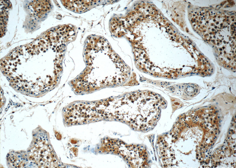 Immunohistochemistry of paraffin-embedded human testis tissue slide using Catalog No:107037(CCT3 Antibody) at dilution of 1:50