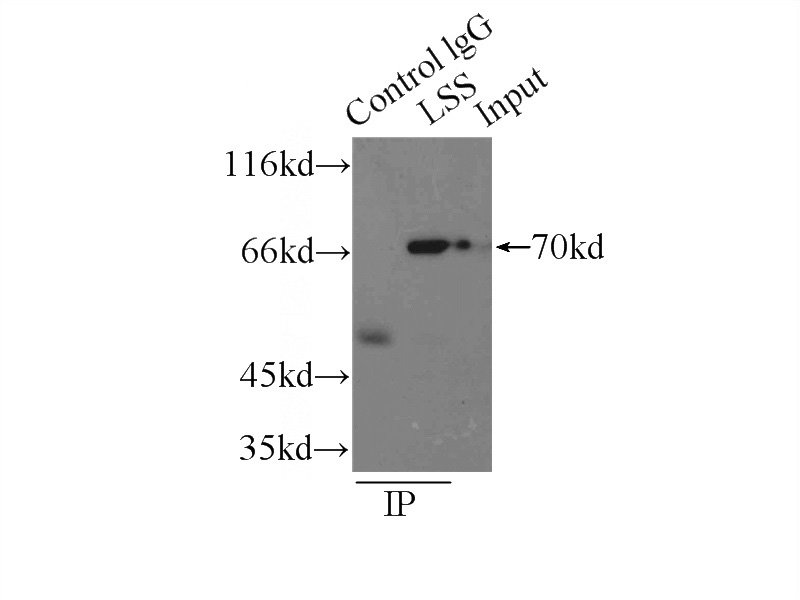 IP Result of anti-LSS (IP:Catalog No:112355, 3ug; Detection:Catalog No:112355 1:500) with HepG2 cells lysate 2900ug.