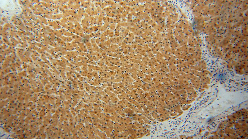 Immunohistochemical of paraffin-embedded human liver using Catalog No:111010(GNPNAT1 antibody) at dilution of 1:100 (under 10x lens)