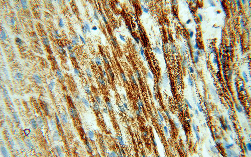 Immunohistochemical of paraffin-embedded human heart using Catalog No:113678(PDHA1 antibody) at dilution of 1:100 (under 40x lens)