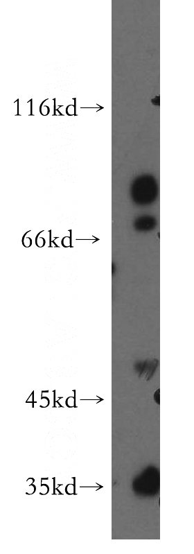 SH-SY5Y cells were subjected to SDS PAGE followed by western blot with Catalog No:108768(CACNG5 antibody) at dilution of 1:300