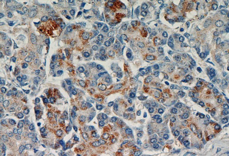 Immunohistochemical of paraffin-embedded human pancreas using Catalog No:112317(LRDD antibody) at dilution of 1:50 (under 40x lens)