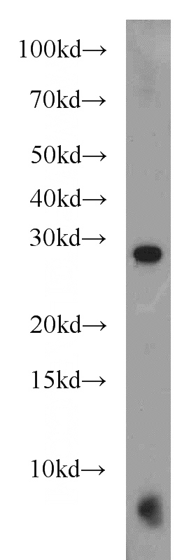 Jurkat cells were subjected to SDS PAGE followed by western blot with Catalog No:108415(BAK antibody) at dilution of 1:3000