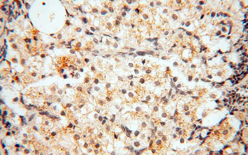 Immunohistochemical of paraffin-embedded human ovary using Catalog No:109844(DCN antibody) at dilution of 1:50 (under 40x lens)