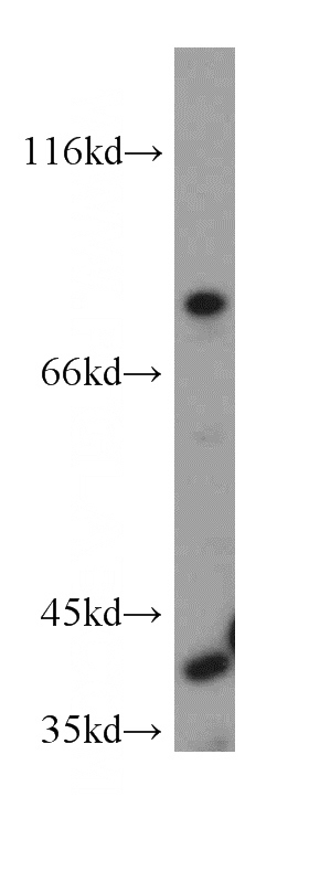 HeLa cells were subjected to SDS PAGE followed by western blot with Catalog No:116015(TFPI antibody) at dilution of 1:500