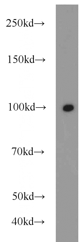 HeLa cells were subjected to SDS PAGE followed by western blot with Catalog No:112659(MEPE antibody) at dilution of 1:1500