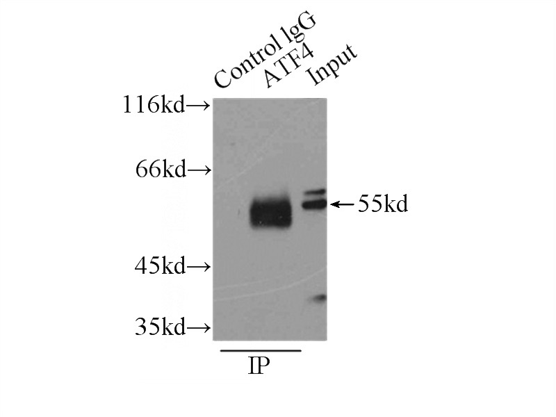 IP Result of anti-ATF4 (IP:Catalog No:108285, 3ug; Detection:Catalog No:108285 1:400) with HEK-293 cells lysate 6000ug.