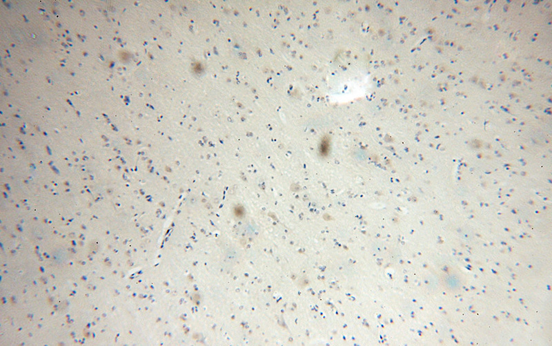Immunohistochemical of paraffin-embedded human brain using Catalog No:113353(NudCL antibody) at dilution of 1:100 (under 10x lens)