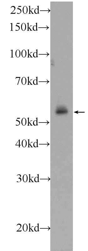 HeLa cells were subjected to SDS PAGE followed by western blot with Catalog No:108626(C19orf61 Antibody) at dilution of 1:600