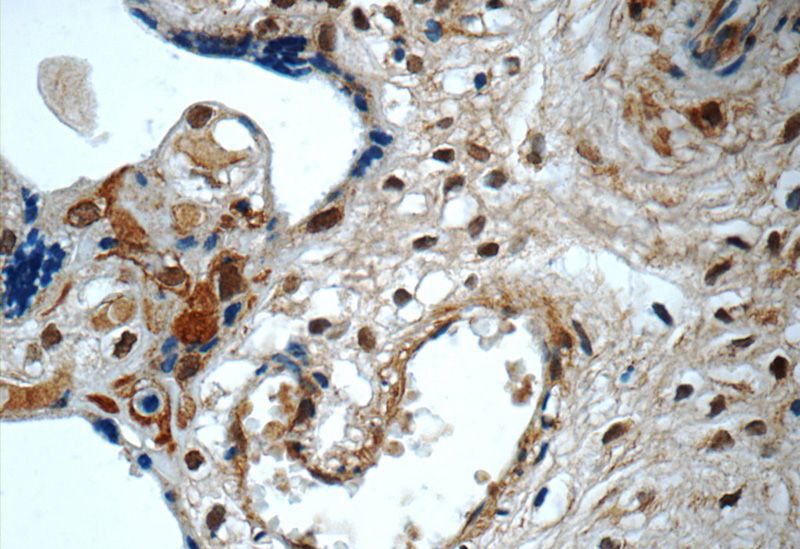 Immunohistochemistry of paraffin-embedded human placenta tissue slide using Catalog No:115418(SMAD4 Antibody) at dilution of 1:50 (under 40x lens)
