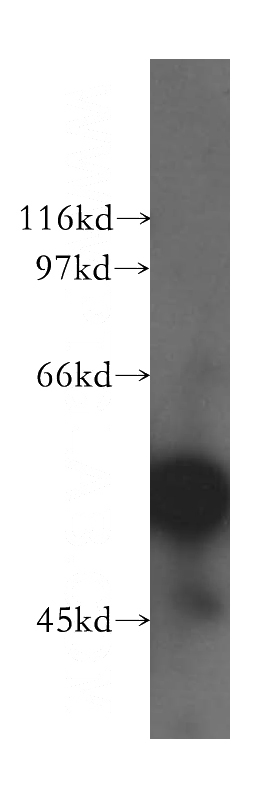NIH/3T3 cells were subjected to SDS PAGE followed by western blot with Catalog No:111087(GPC1 antibody) at dilution of 1:300